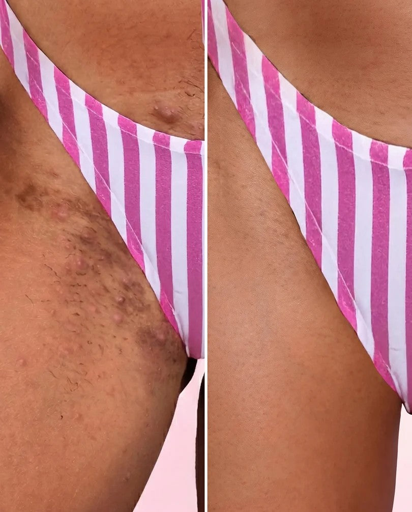 Bella skin 3 en1 - additional image 1