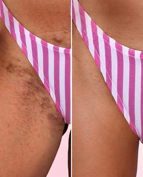 Bella skin 3 en1 - additional image 1